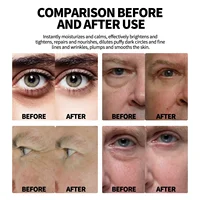 Retinol Eye Bag Removal Cream For Men Anti-Wrinkle Firming Skin Fades Fine Lines Anti Dark Circle Puffiness Brightening Eye Care 3