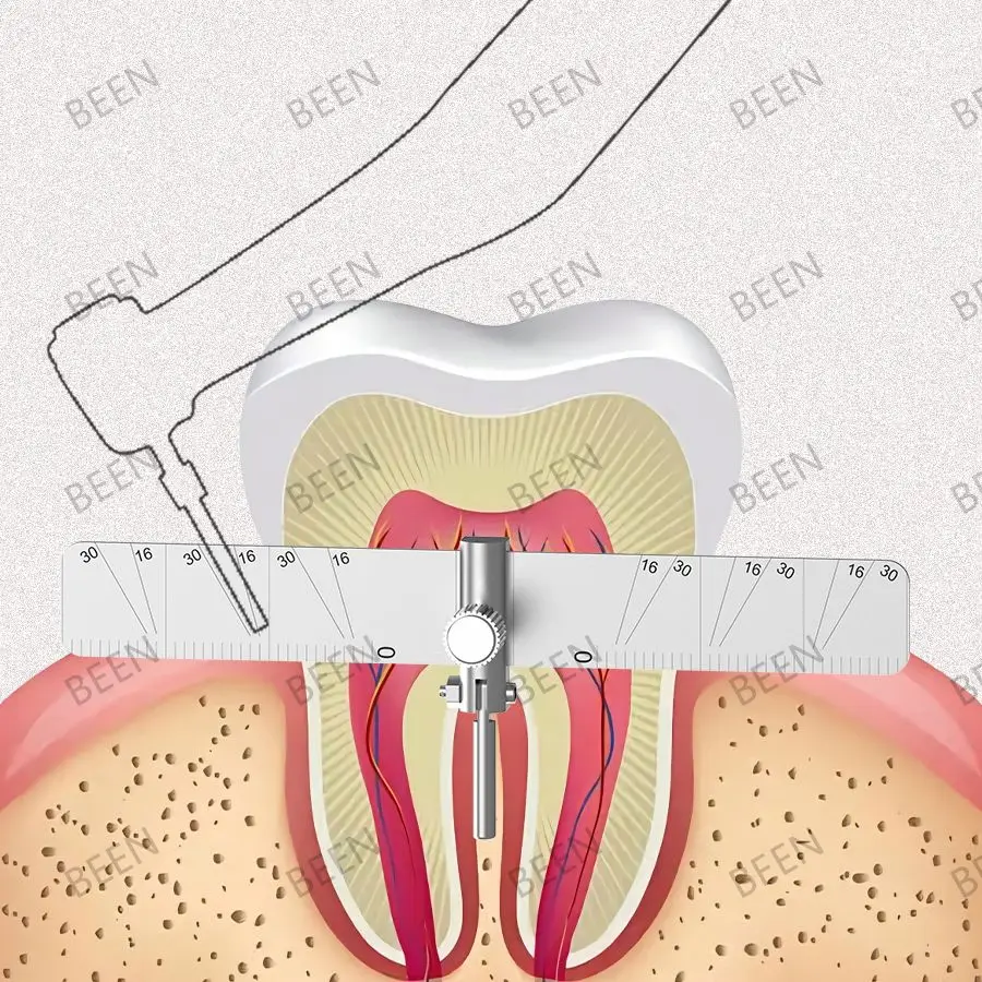 Dental ALLON4 Implant Locating Guide Surgical Planting Locator Dental Positioning Angle Ruler Guage Autoclavable