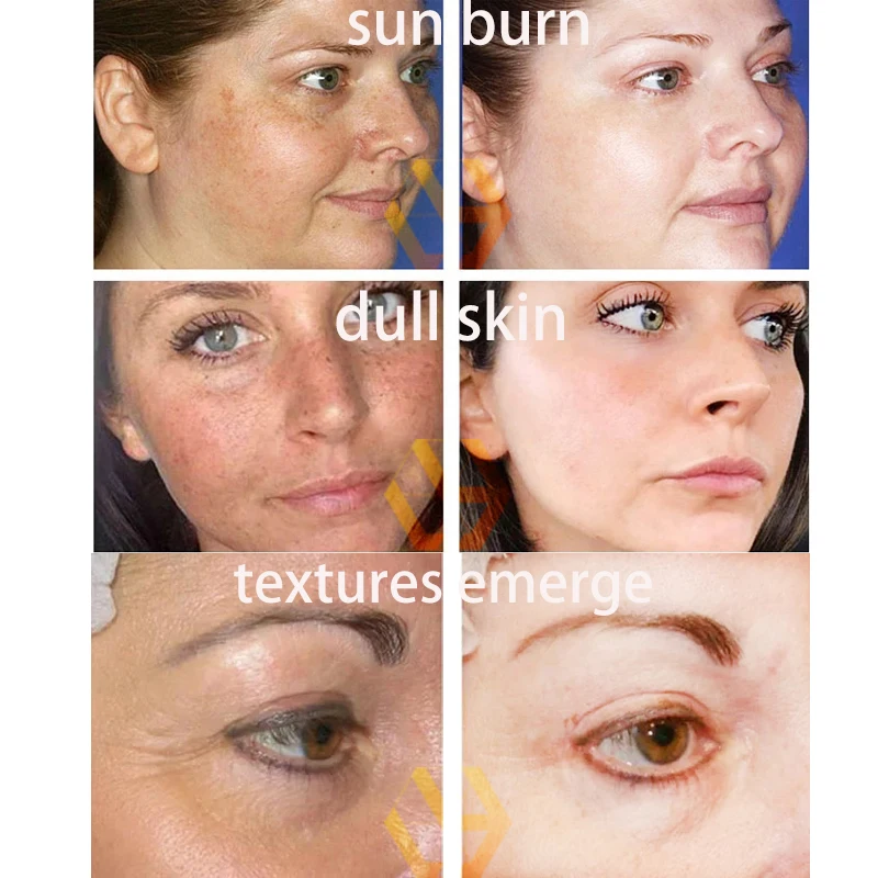 Body Dark Spot Remover Skin Spot Whitening Remove Facial Dark Spots Melasma Sunspots Skin Serum Beauty Essence