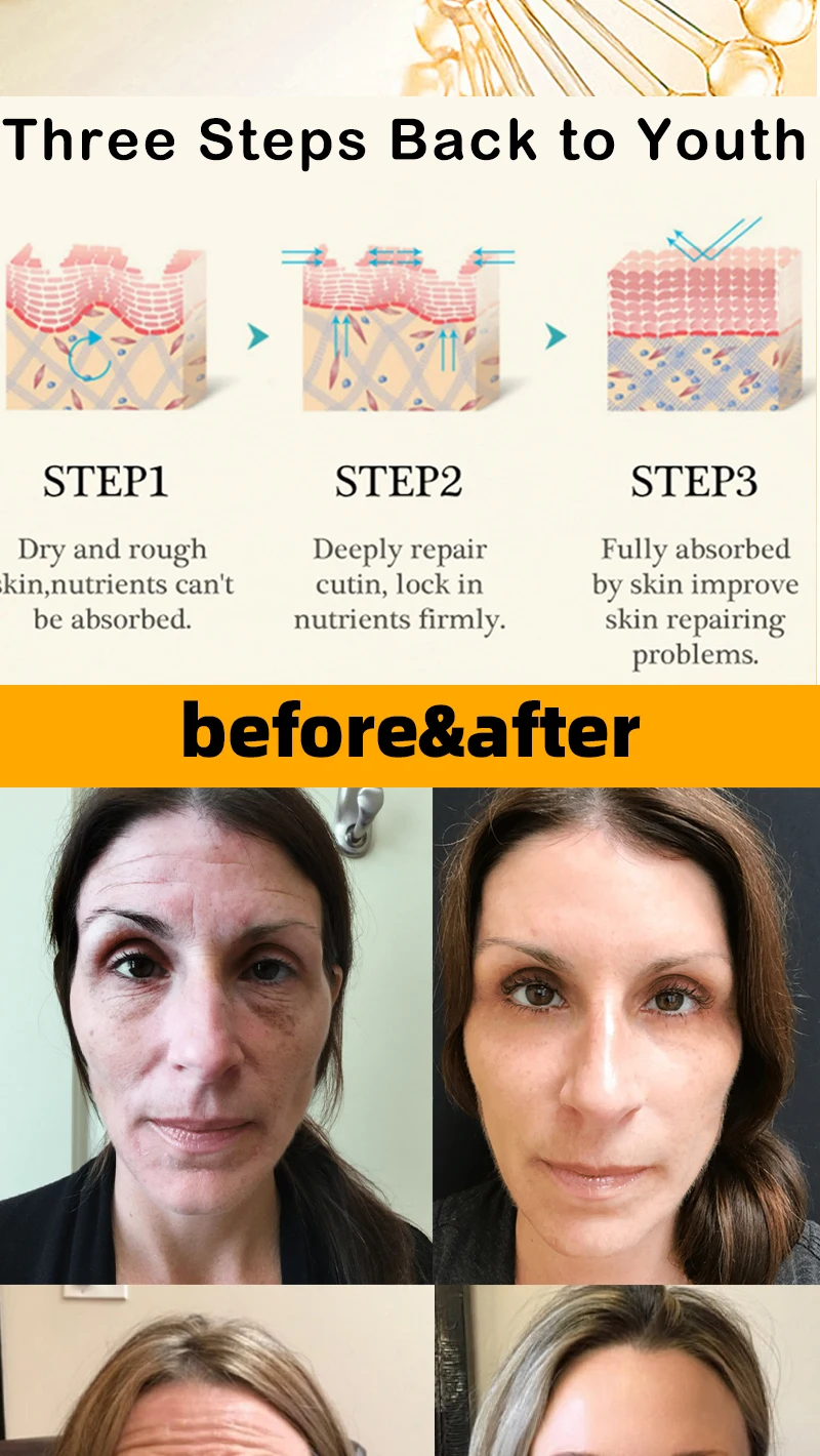No Fine Lines ,For Wrinkles And Does Not Look Old_voghion.com