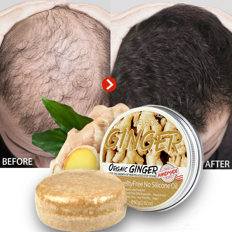 

Ginger Hair Growth Soap Fast Growing Anti Hair Loss Serum Treatment Hair Dry Frizzy Damaged Repair Men Women Hair Care Products