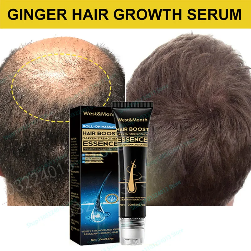 Strong Effect Hair Growth Products Ginger Essential Oil 2 Week Treat Hair Loss Scalp Repair Nourish Hair Roots Regrowth