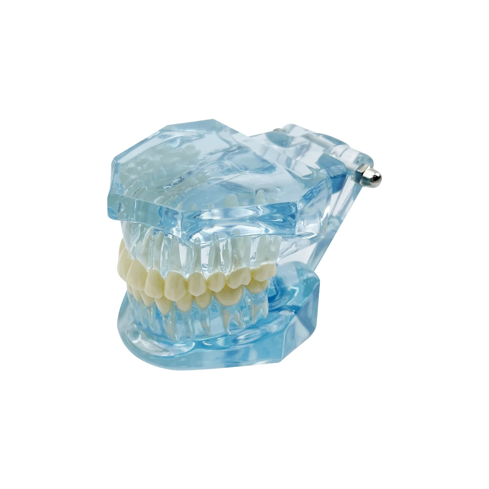 Normale Dental Modell Zähne Dental Lehrmodell Transparent Blau Rosa Zahnmedizin Erwachsene Zähne Modell Für Studieren Bildung Display – Detail 9