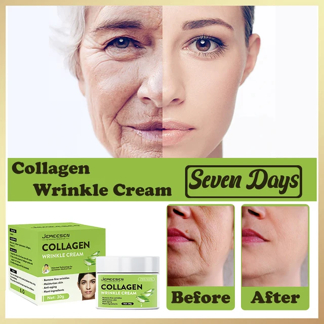 Crème Anti-rides au collagène pour le visage, Anti-âge, rétinol, dissolvant de taches foncées, sérum blanchissant, soins pour la peau