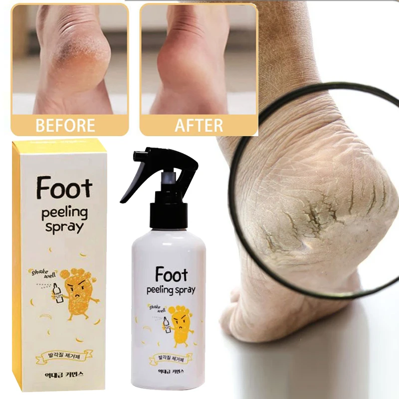 

Sdotter Foot exfoliating repair brightening spray Anti-Drying Crack peeling Treatment Removal Dead Skin calluses feet whiten car