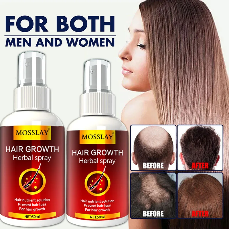 Hair Growth Serum Spray Fast Hair Growth Liquid Treatment Scalp Hair