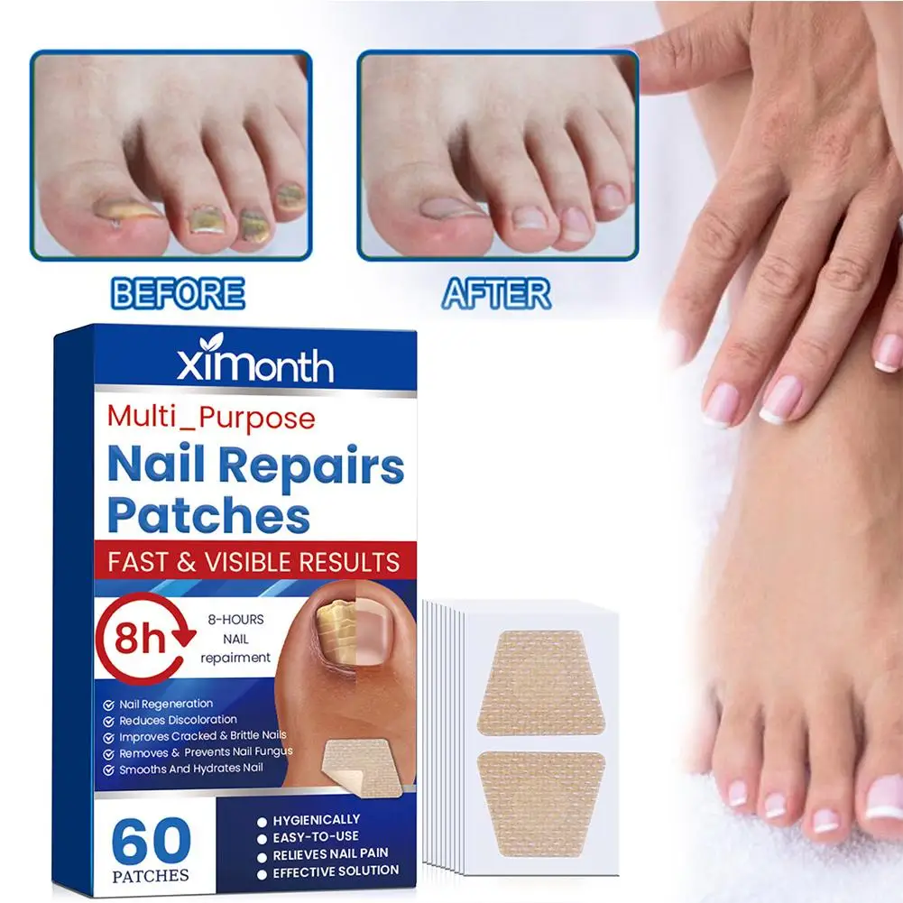 Nail repair stickers