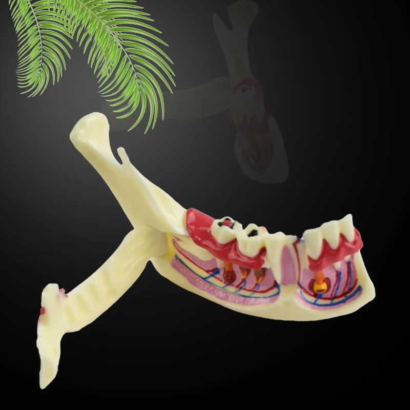 

Dental Endodontic Treatment Model Mandible Tissue Anatomical Model Anatomy of Gums Study Dental Materials