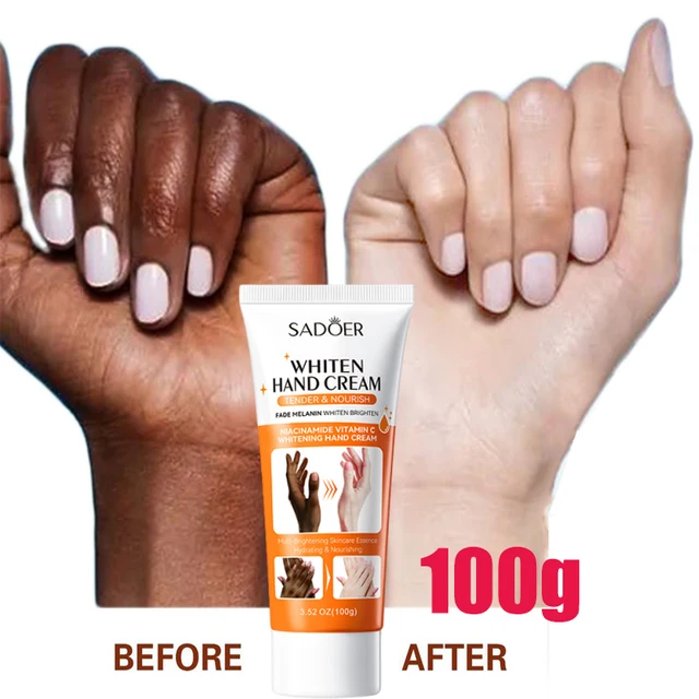 Sérum éclaircissant rapide pour les jointures sombres, crème anti-gerçures, correcteurs de pigmentation pour peaux noires, produits éliminateurs de taches tenaces 1