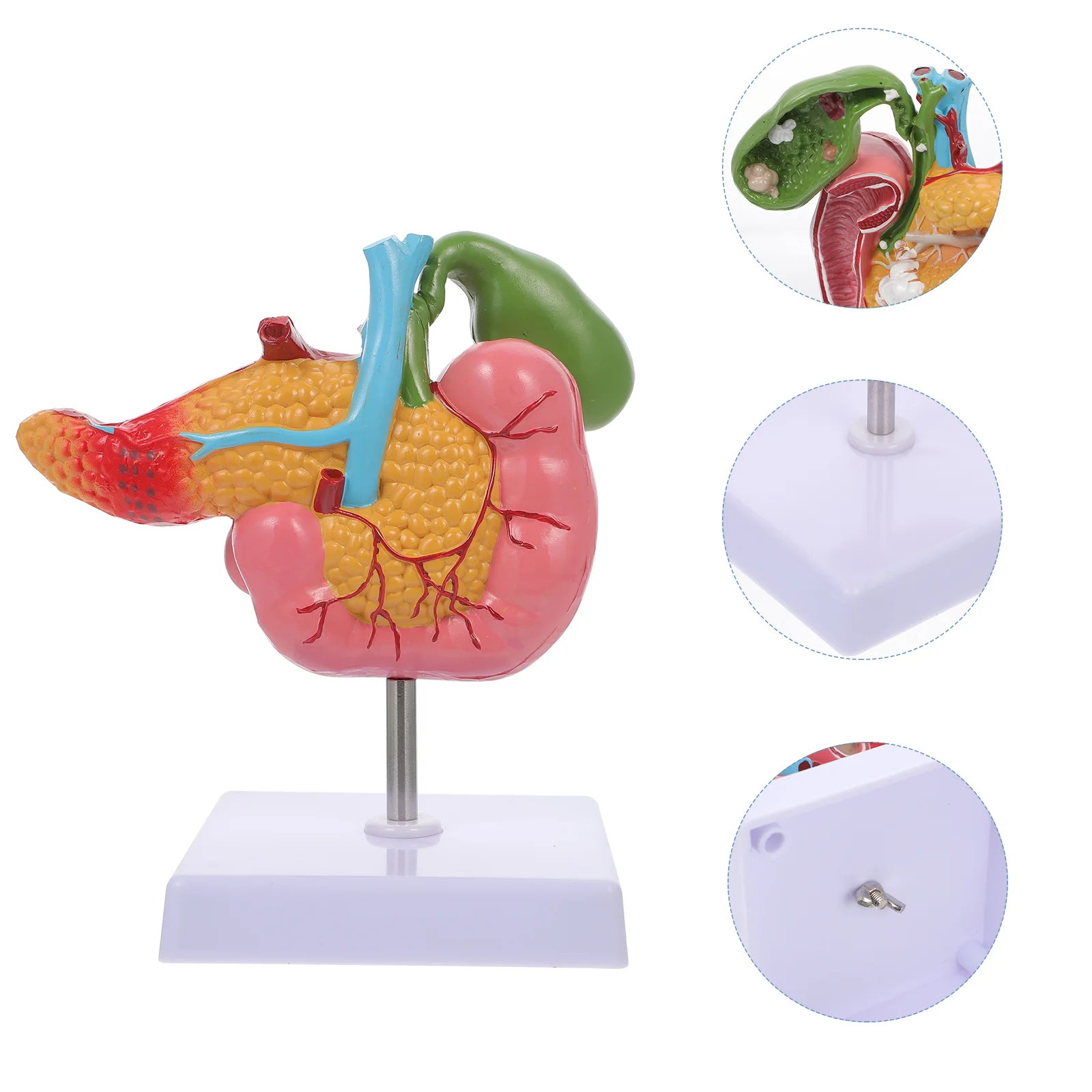 

Pathological Model of Gallbladder Anatomy Study Tool Duodenum Lesion Human Duodenal Pvc Gallstone Digestive System Pancreas