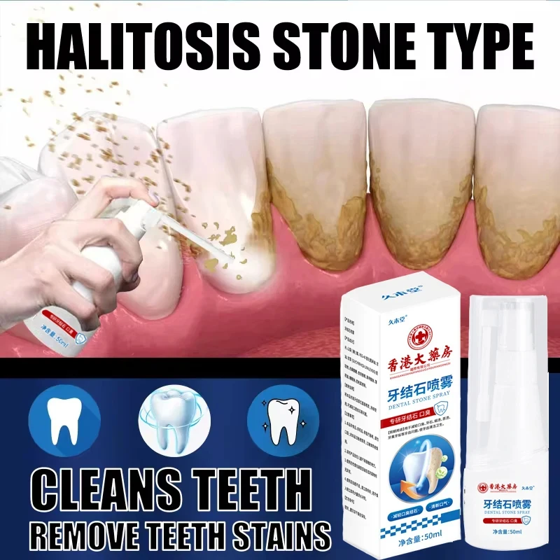 Dental Calculus Remover Dental Calculus Remover Teeth Whitening Spray Fresh Breath Care Toothpaste Cleaning Oral Hygiene Removal Halitosis Plaque Stains