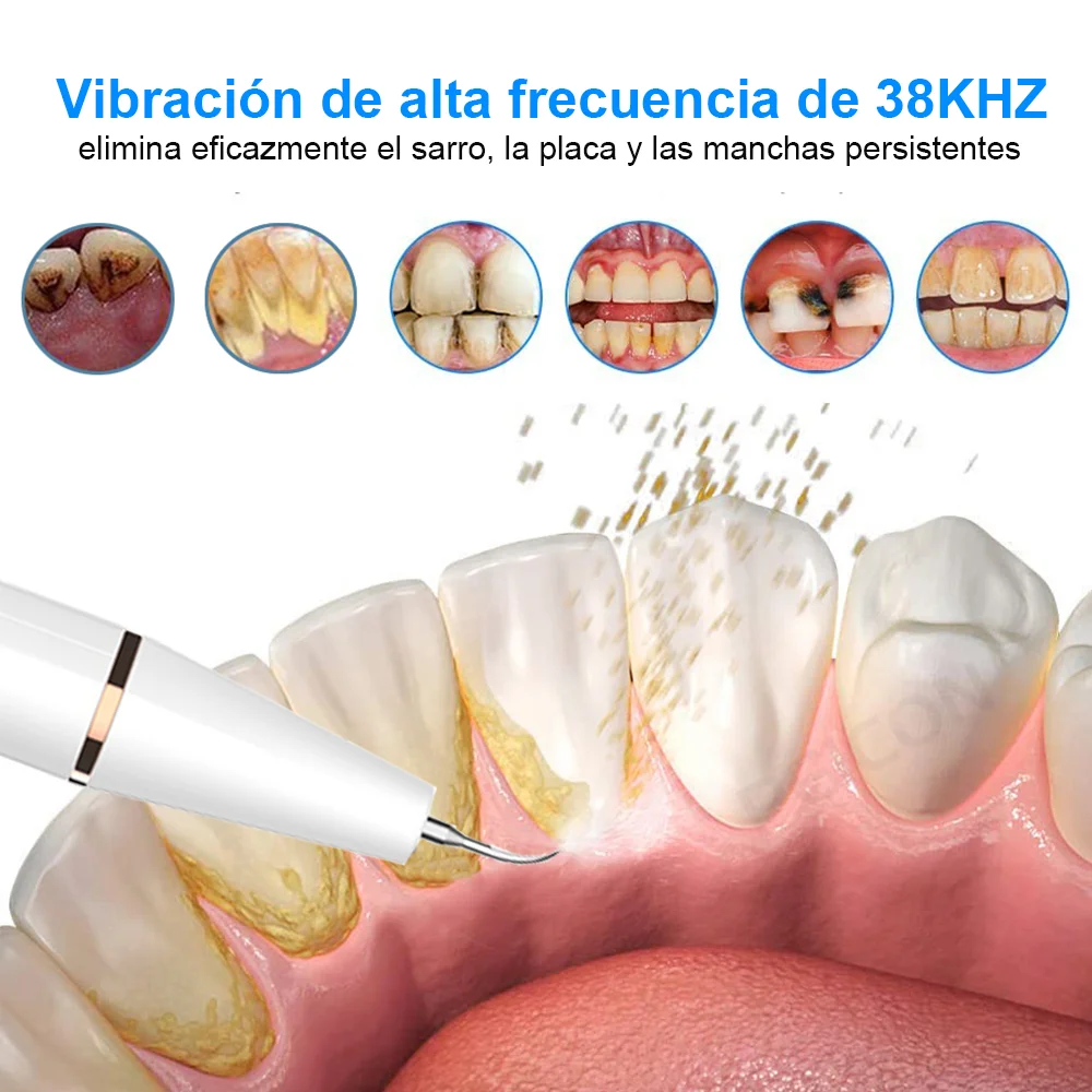 Ultrasonic Dental Scaler Electric Oral Teeth Tartar Remover Calculus Plaque Stains Cleaner Removal Teeth Whitening Tool with LED