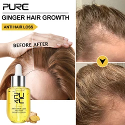 PURC Ginger Hair Growth Products for Men Women Anti Hair Loss Fast Grow Oil Thicken Essentials Serum Scalp Treatment Hair Care