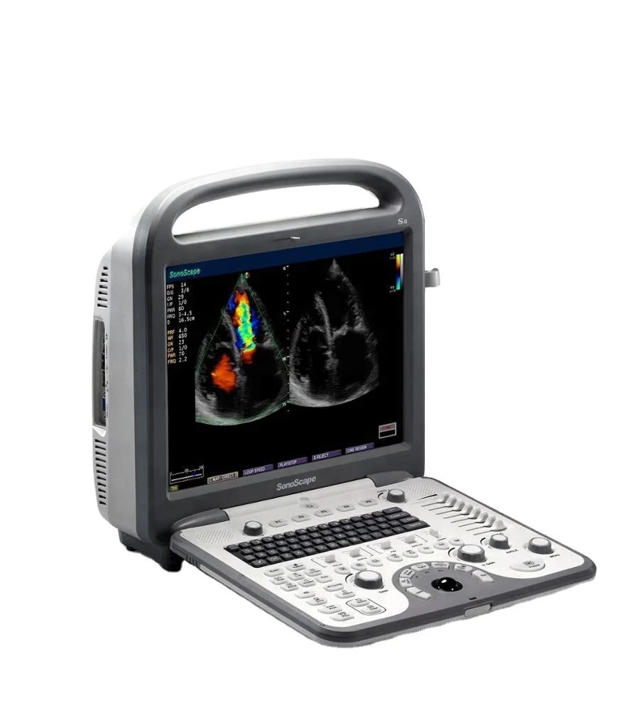 

Products subject to negotiationPortable Sonoscape Color Doppler ultrasound machine Sonoscape S8