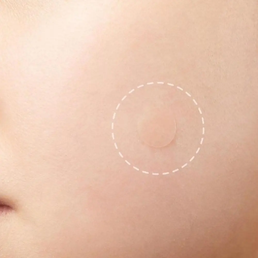 72Pcs Invisible Removal Pimple Anti-Acne Hydrocolloid Patches Spots Marks Concealer Waterproof Repair Sticker 2