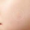 72Pcs Invisible Removal Pimple Anti-Acne Hydrocolloid Patches Spots Marks Concealer Waterproof Repair Sticker 2