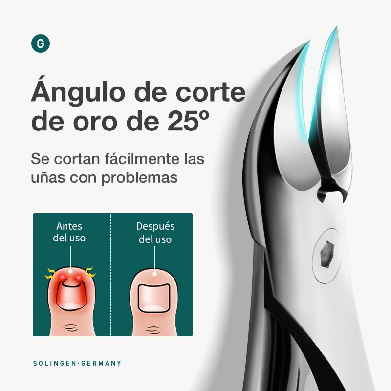 MR.GREEN Nail Clippers Toenail Cutters Pedicure Manicure Tools  Ingrown Paronychia Professional Correction Tool Sets — view 2