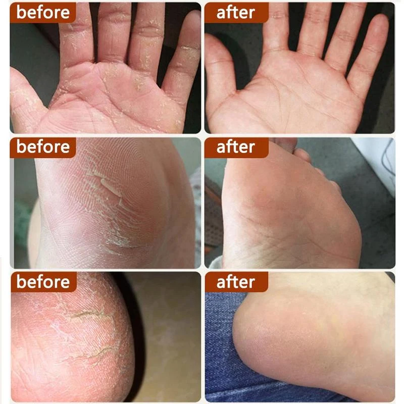 Anti-Drying Crack Hand Foot Care Cream Repair Heel Crack Remove Dead Skin Mask Nourish Hand Chapping Moisturize Whiten Skin Care
