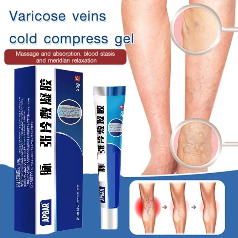 

20g Varicose Vein Treatment Effective Varicose Vein Relief Vasculitis Phlebitis Spider Web Pain Treatment Leg Health Care