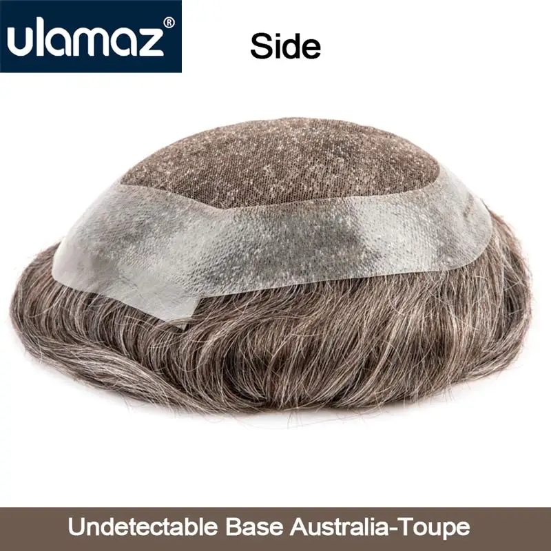 Рисунок 6 - Парик 6*8/7*9, швейцарский протез