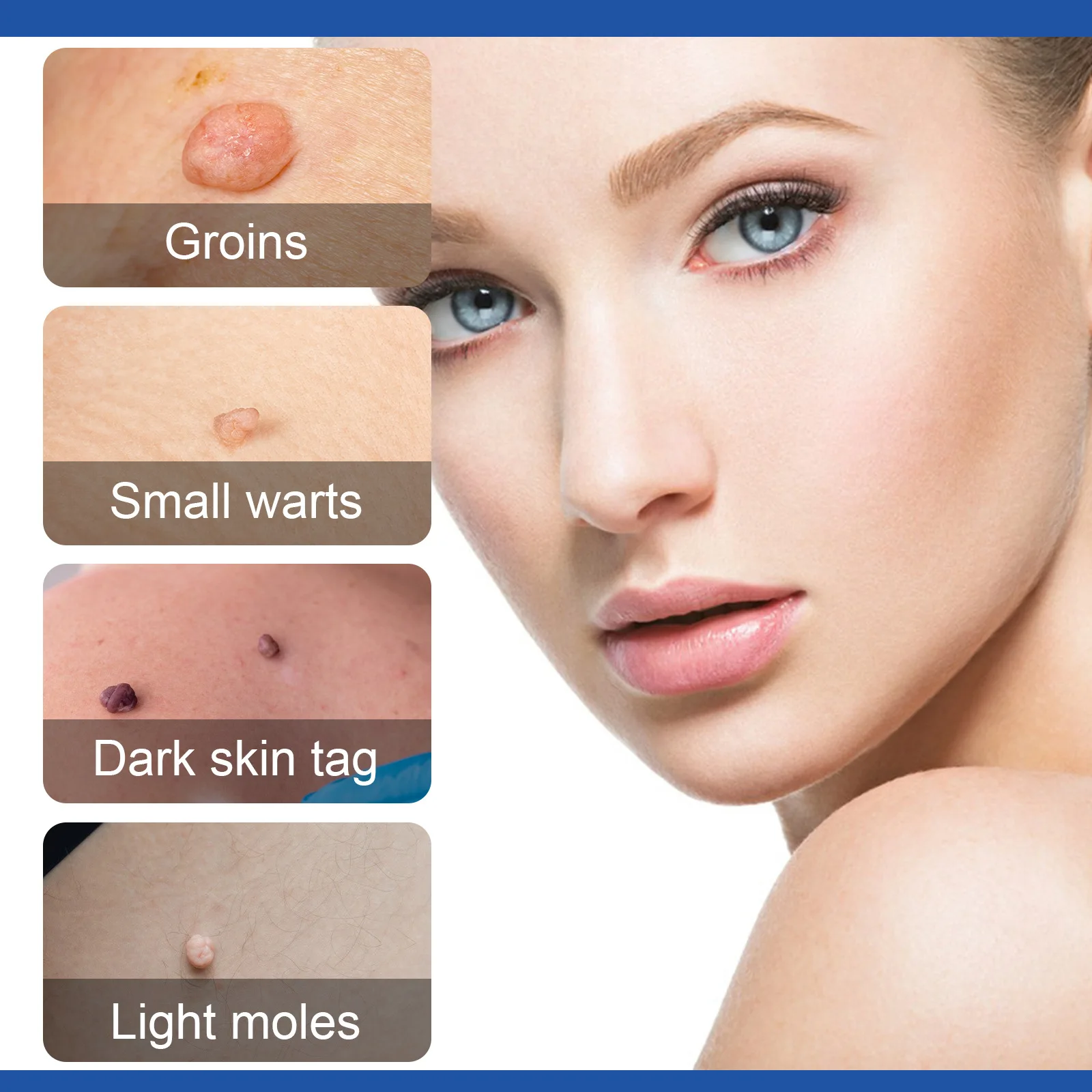 مجموعة إزالة علامات الجلد كبيرة الحجم تلقائيًا لعل...