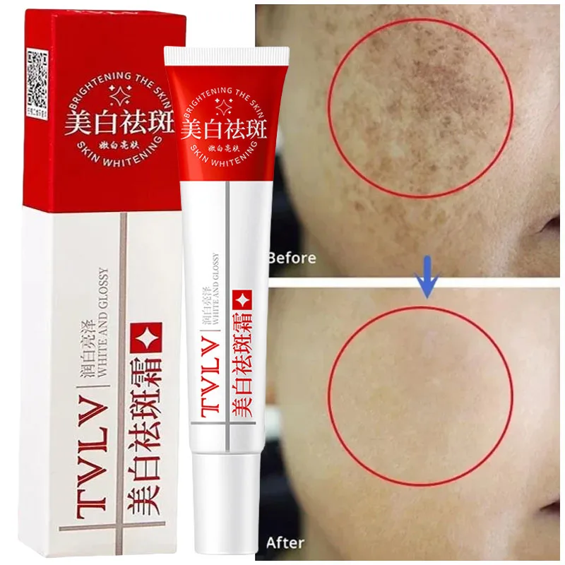 

Whitening Freckle Cream Melasma Dark Spots Pigmentation Removal Products Fade Stain Melanin Repair Brighten Korean Skin Care