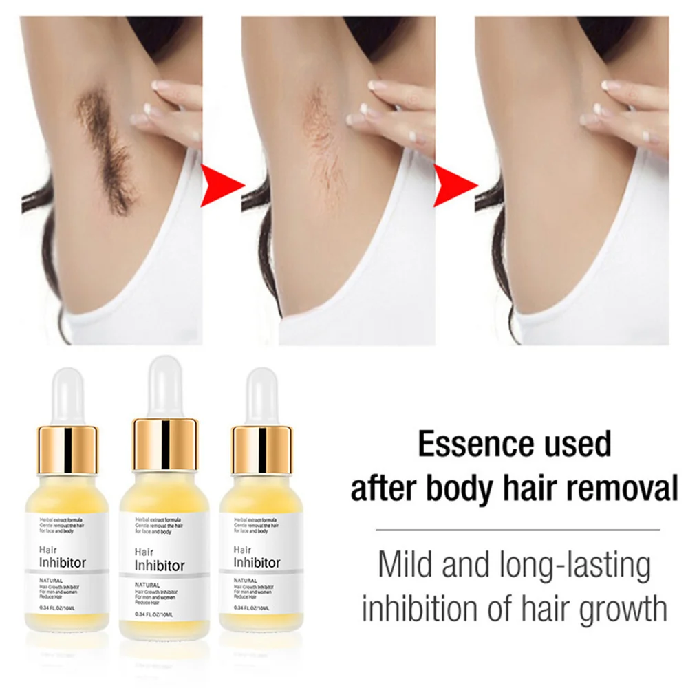 Gentle and painless hair removal Continuous suppression serum, painless removal agent legs, arms, growth inhibitors, hair_voghion.com
