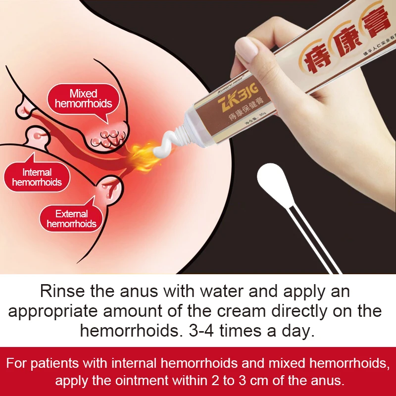 20g Hemorrhoid ointment for the treatment of internal hemorrhoids, hemostasis, anti-inflammatory, anti infection, and healing