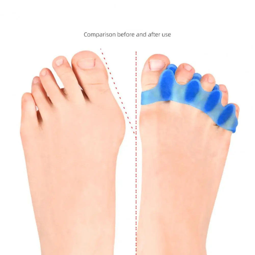 Toe Separators for Walking Yoga Toe Spacers Bunion Corrector Toe Separators for Women Men Spacers Straighteners Stretcher