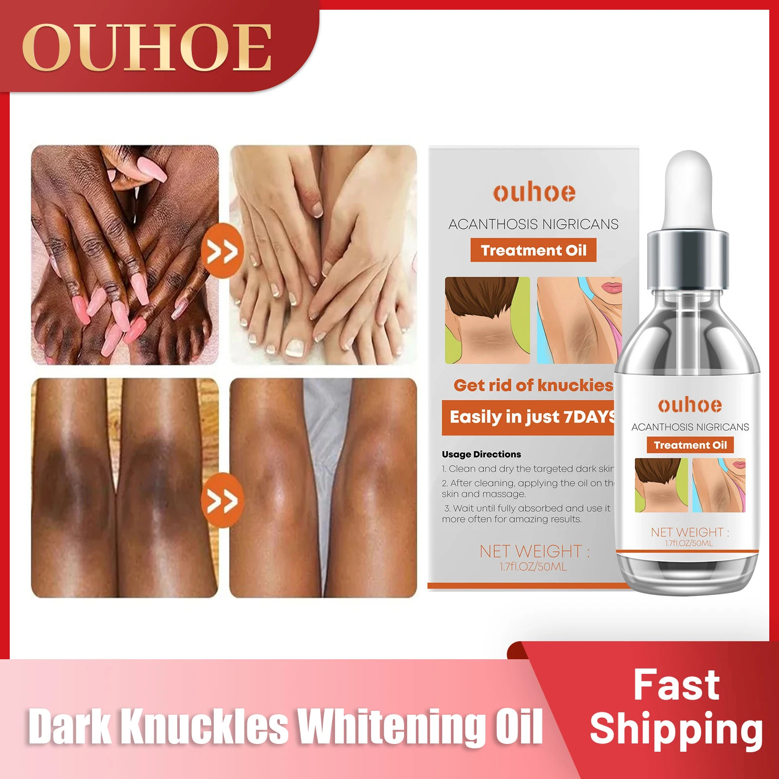 Dark Knuckle Whitening Serum Get Rid of Dark Knuckles Removal Oil Dark Spots Pigmentation Correctors for Black Skin Elbow Knee dark knuckle whitening serum get rid of dark knuckles removal oil dark spots pigmentation correctors for black skin elbow knee