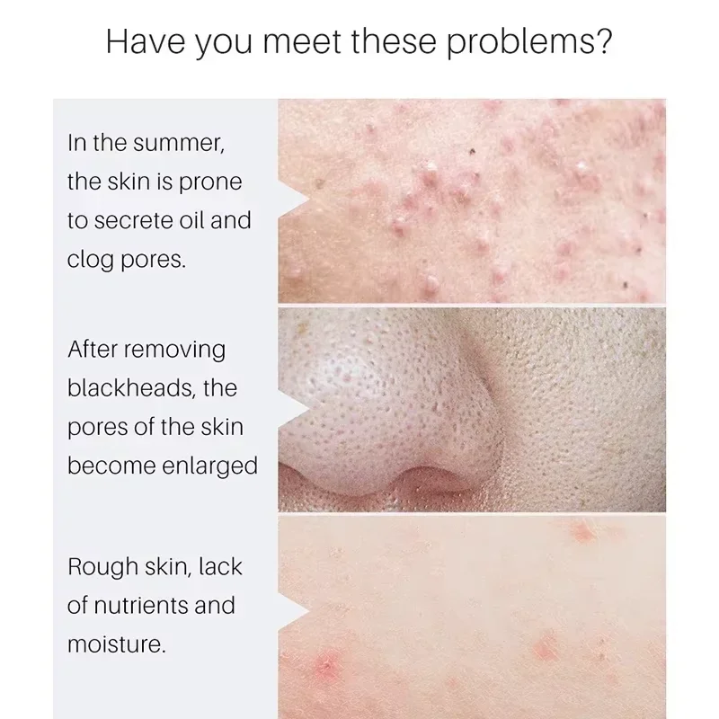 Skin Texture | Pore Refining Resurfacing, Brightening Facial Serum with Retinol and Niacinamide Non-Comedogenic 2