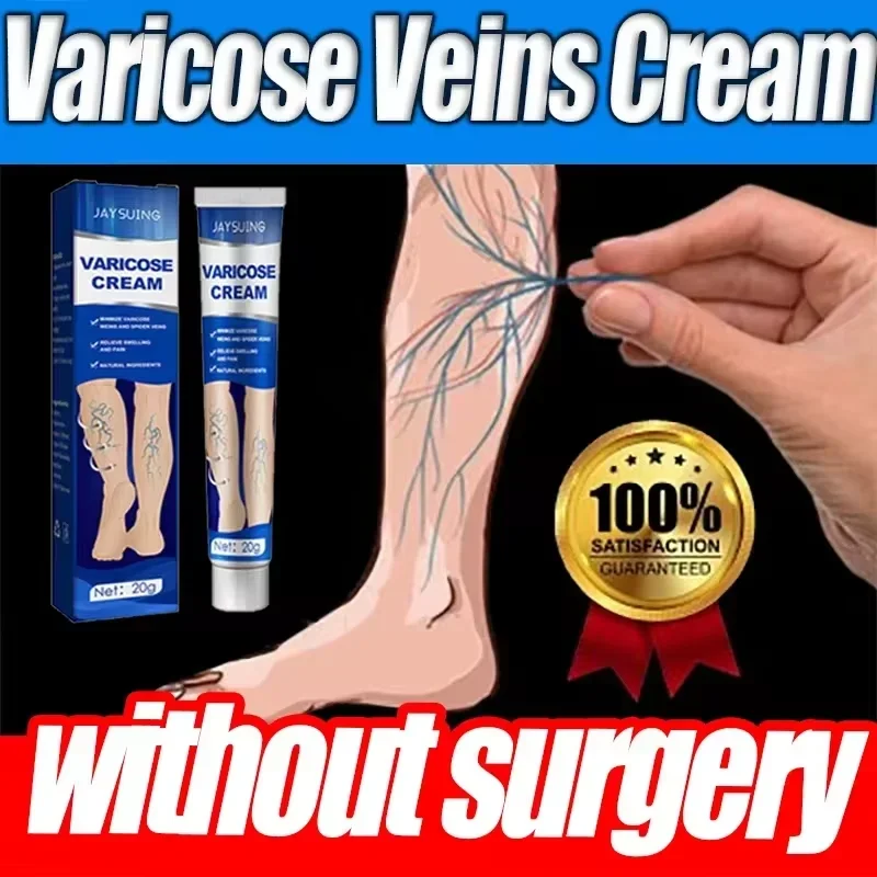 Ointment for Varicose Veins Eliminate Vasculitis Phlebitis to Relieve Spider Leg Pain Treatment Herbal cream 3