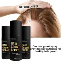 Spray pour la croissance des cheveux, 50ml, favorise la santé des follicules pileux, Production de mélanine, traitement d'épaississement des cheveux pour hommes et femmes, soins capillaires 3