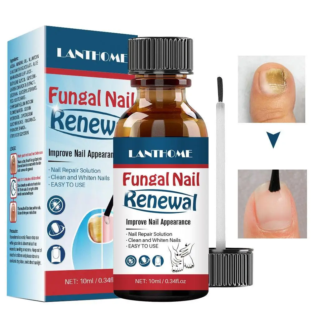 10ml LANTHOME Nail Fungal Treatment Feet Care Essence Anti Infection Paronychia Onychomycosis Foot Toe Nail Fungus Removal