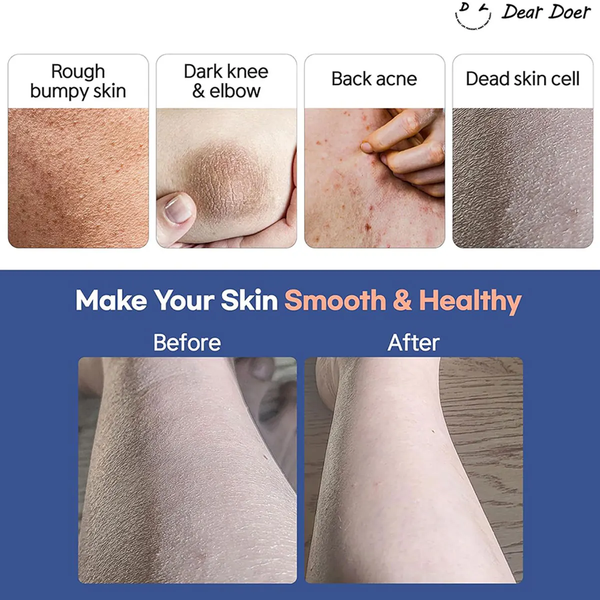 DearDoer Vegan Body Scrub - Gentle Granular Texture, 300ml, K-Beauty Skincare Essential