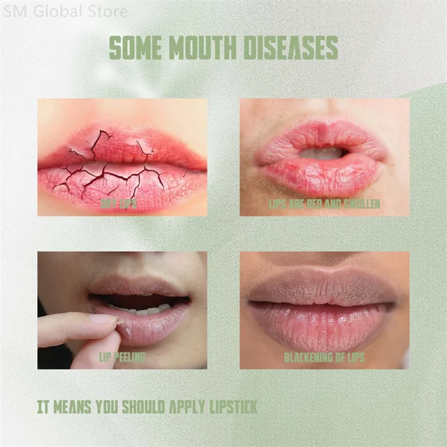 56379-9f4619.jpg Remove Dark Lip Balm Lighten Melanin Lip Mask Exfoliating Fade Lip Line Dead Skin Moisturizing Brighten Repair Lip Care Products