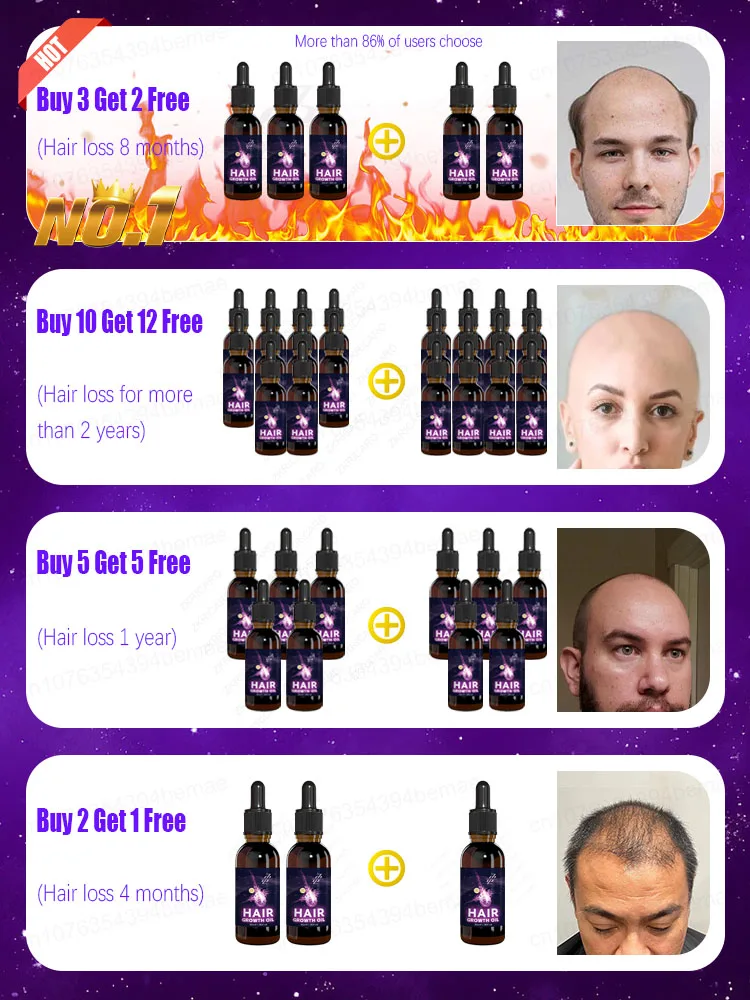 Designed specifically for those suffering from hair loss，No Add chemical stimulation
