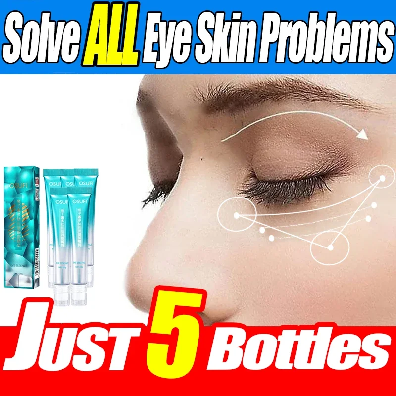 Anti-Wrinkle Eye Cream Retinol Remove Eye Bags Dark Circles Anti Aging Lifting Firming Whitening Moisturizing Brighten Skin Care anti wrinkle eye cream eye cream