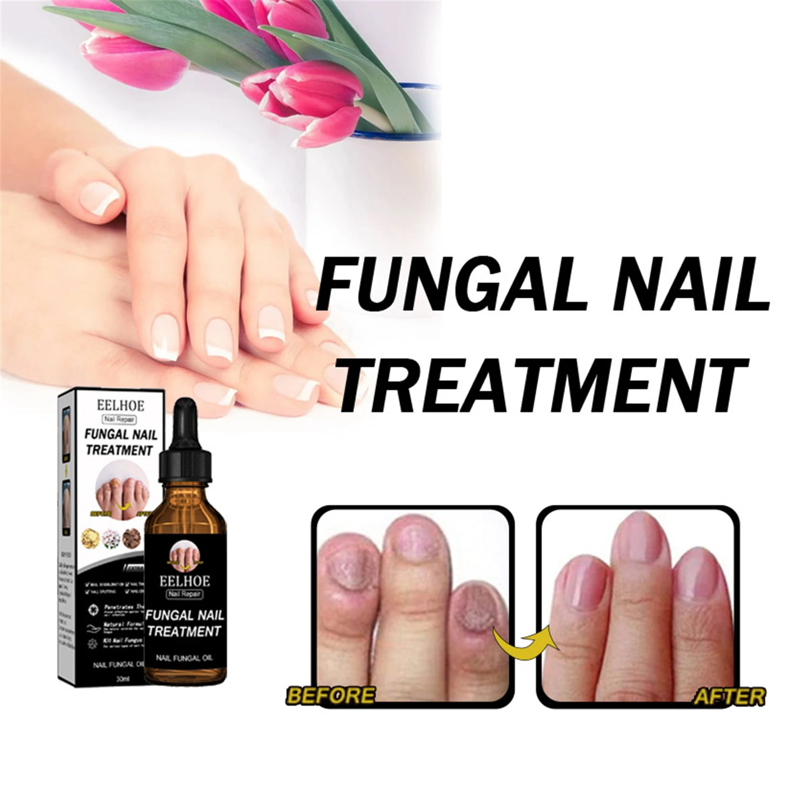 Renewal Nail Repair Solutionnail Fungals For Discolored And Damaged Nails  Nail Fungals For Discolored Broken - Foot Care Tools - AliExpress