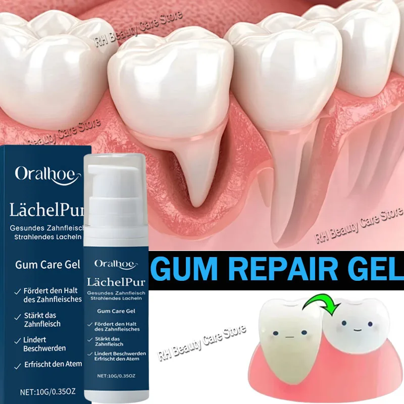 Rapid Repair Gums Gel Effectively Relieve Tooth Allergy Dental Caries Tooth Cleaning Toothpaste Relieve Tooth Damage Serum