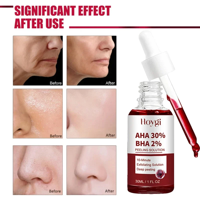 Facial Serum Facial Essence Retinol Face Serum Salicylic Acid Facial Serum