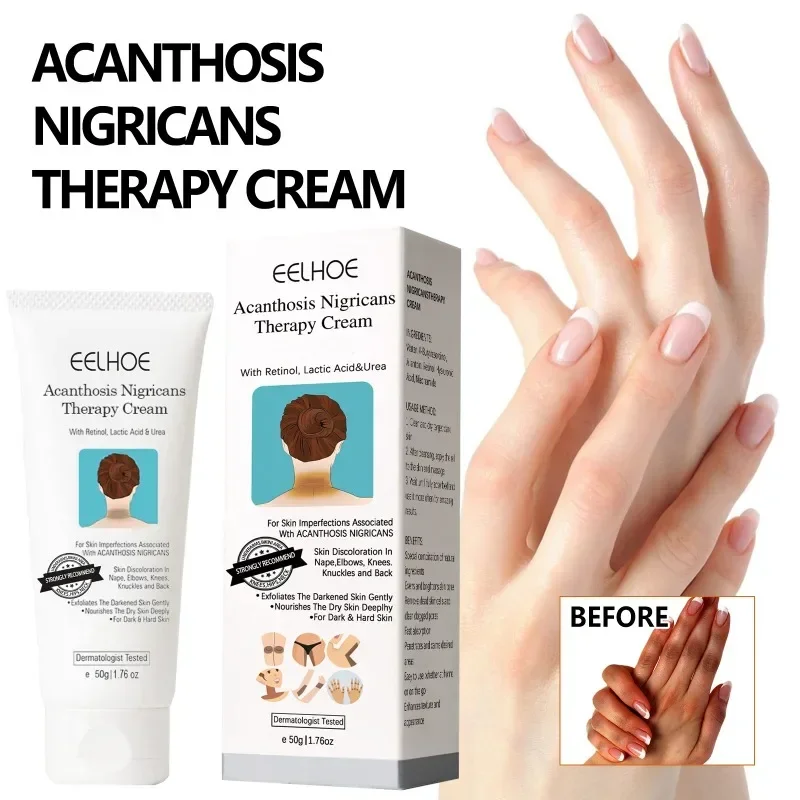 

Sdottor New Body Whitening Cream Arms Armpits Thigh Underarm Knee Elbow Repair Whiten Brighten Moisturizing Dark Remove Skin Car