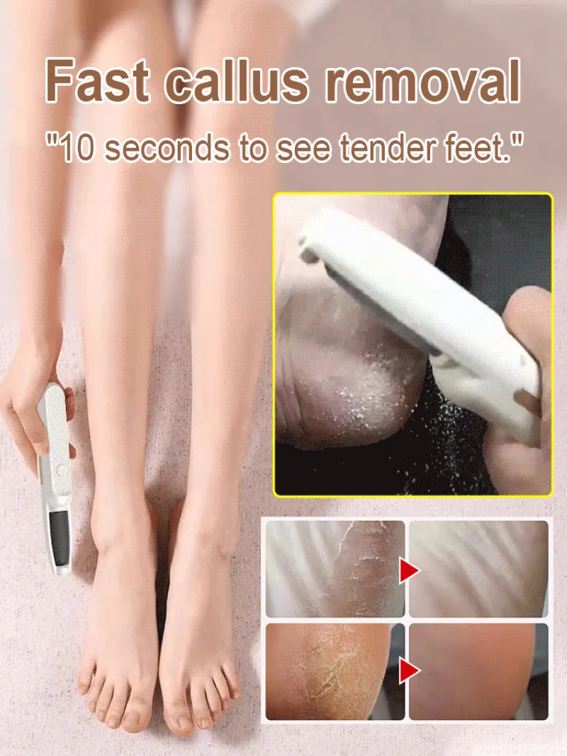 Household Portable Exfoliating Electric Foot Grinder TYPE-C Charging IPX7 Waterproof Three Level Adjustable Foot Grinder 2