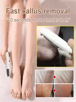 Household Portable Exfoliating Electric Foot Grinder TYPE-C Charging IPX7 Waterproof Three Level Adjustable Foot Grinder 2