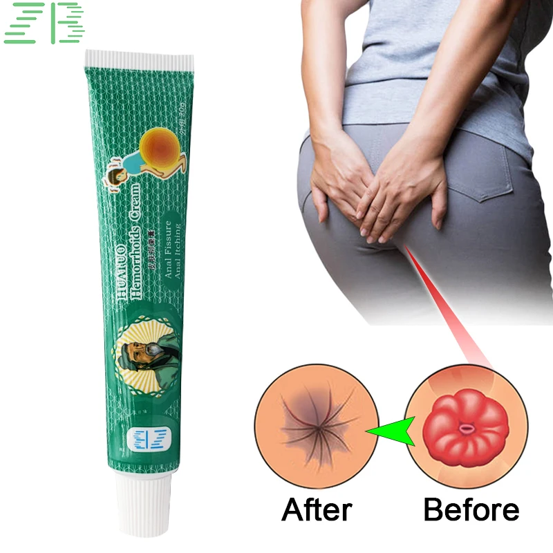 1Pcs20gZBHemorrhoidOintmentTreatInternalAndExternalHemorrhoidAnalPainItchRelief