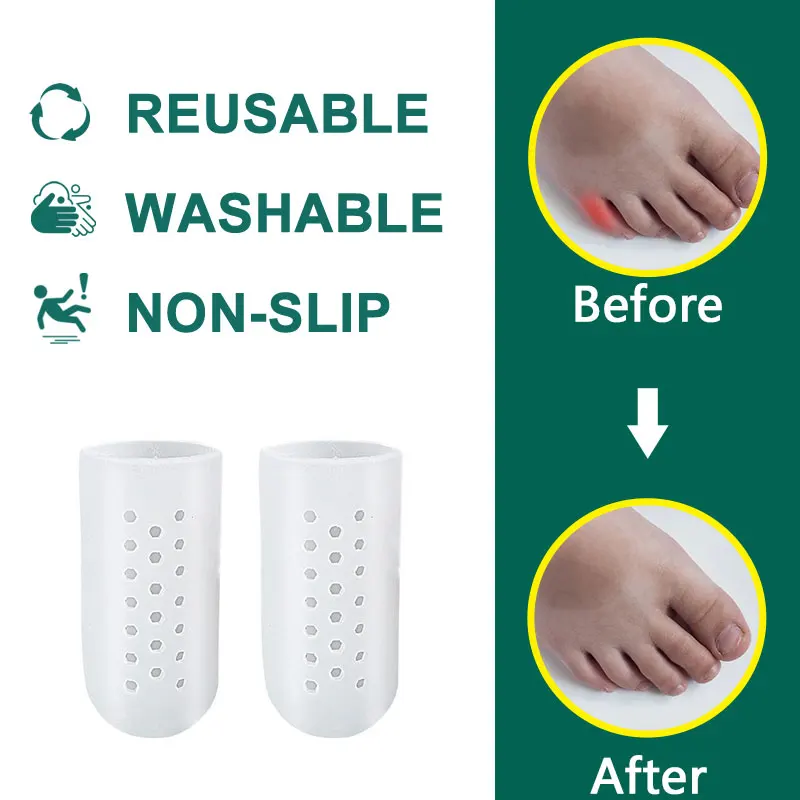 Рисунок 4 - силиконовые разделители для пальцев