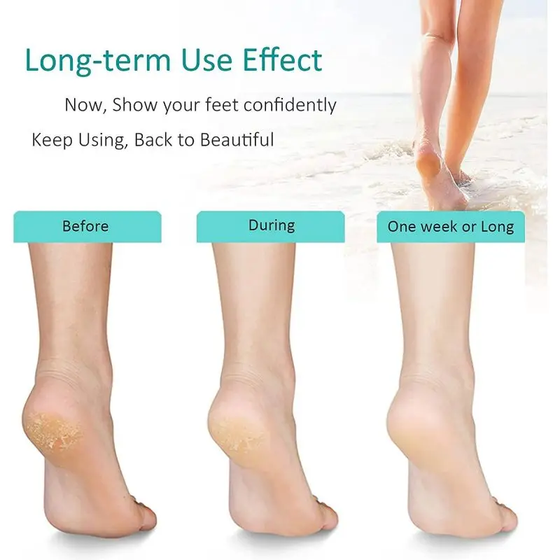 Foot File Hands And Feet Portable Sanding Stone Callus Remover Foot Care Tool Exfoliating Artifact Glass Foot File Pedicure Tool