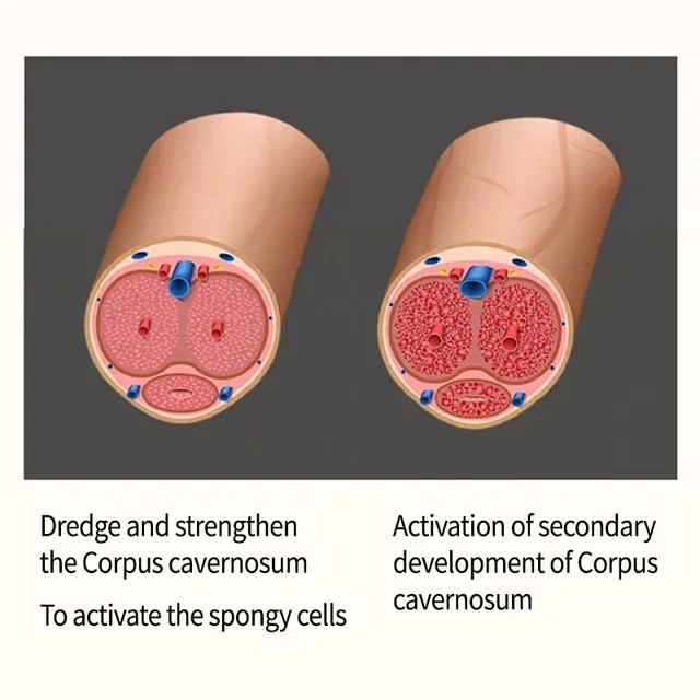 A Férfi Masszázs Illóolajat Olyan Növényekből, Mint Cistanche Deserticola És Az Epimedium Extrahálják Vitalitás Helyreállítása Javítás Érdekében - Image 4