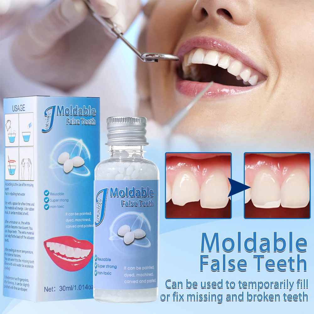 Denture-Solid-Glue-Resin-Temporary-Resin-Tooth-Repair-Glue-Shapeable ...