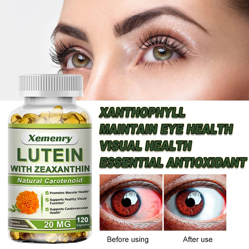 Xemenry Lutein 20 Mg Zeaxanthin Kapseln für Blau Licht Makula ...